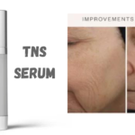 tns serum